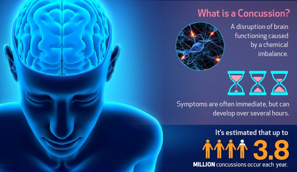 Concussion Center infographic